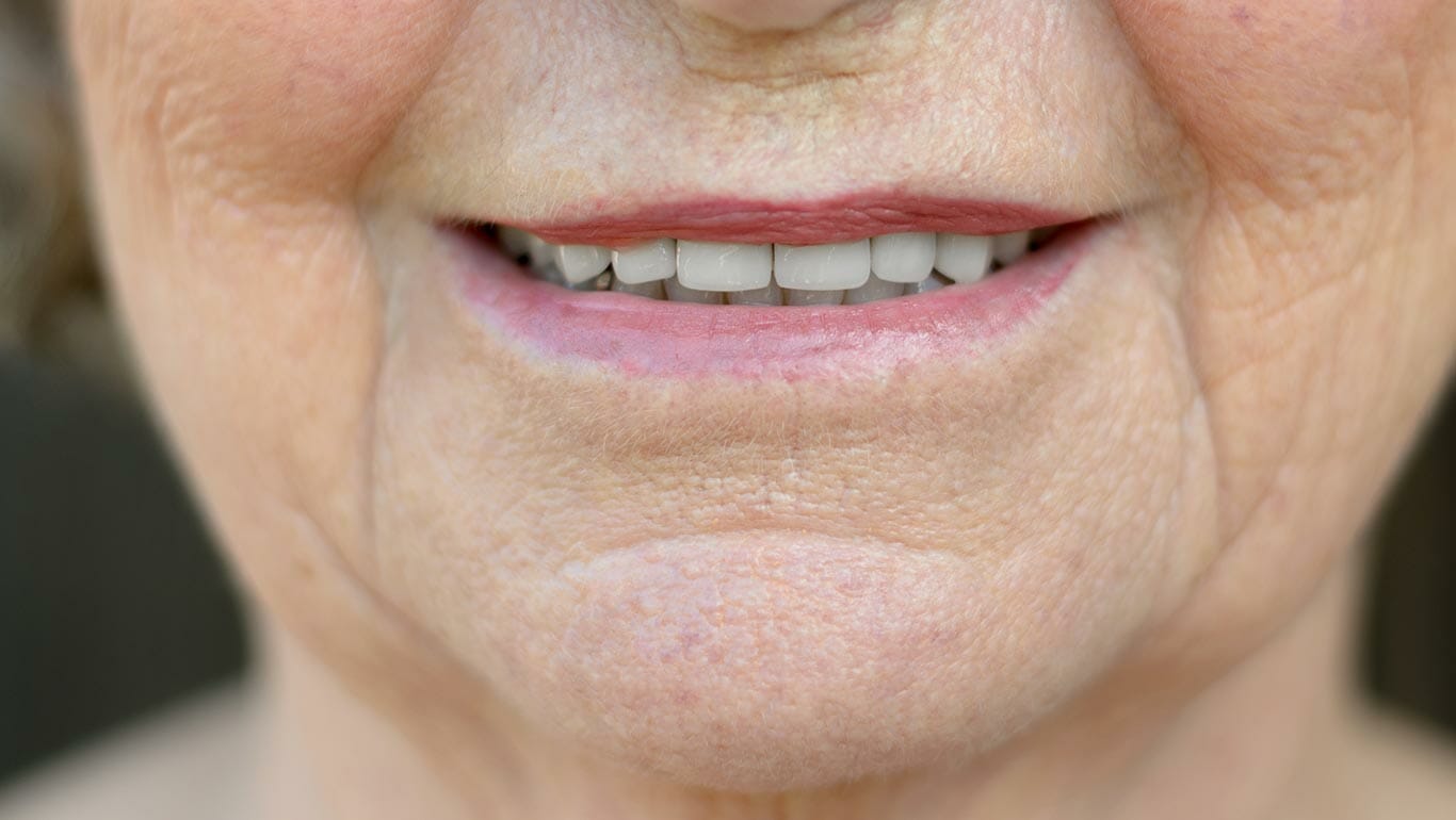 Lines Allura Skin, Laser & Wellness Clinic Fort Collins