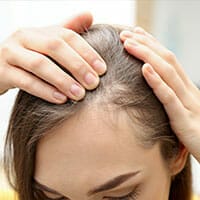 allura-hair-loss-thumbnail