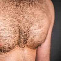 allura-hair-removal-men-thumbnail